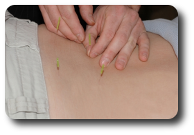 Acupuncture is just one therapy within Chinese medicine.